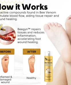 Beegyn™ Bee Venom Diabetic Foot Treatment Spray